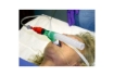 Picture of Oxygen T-Piece Tube